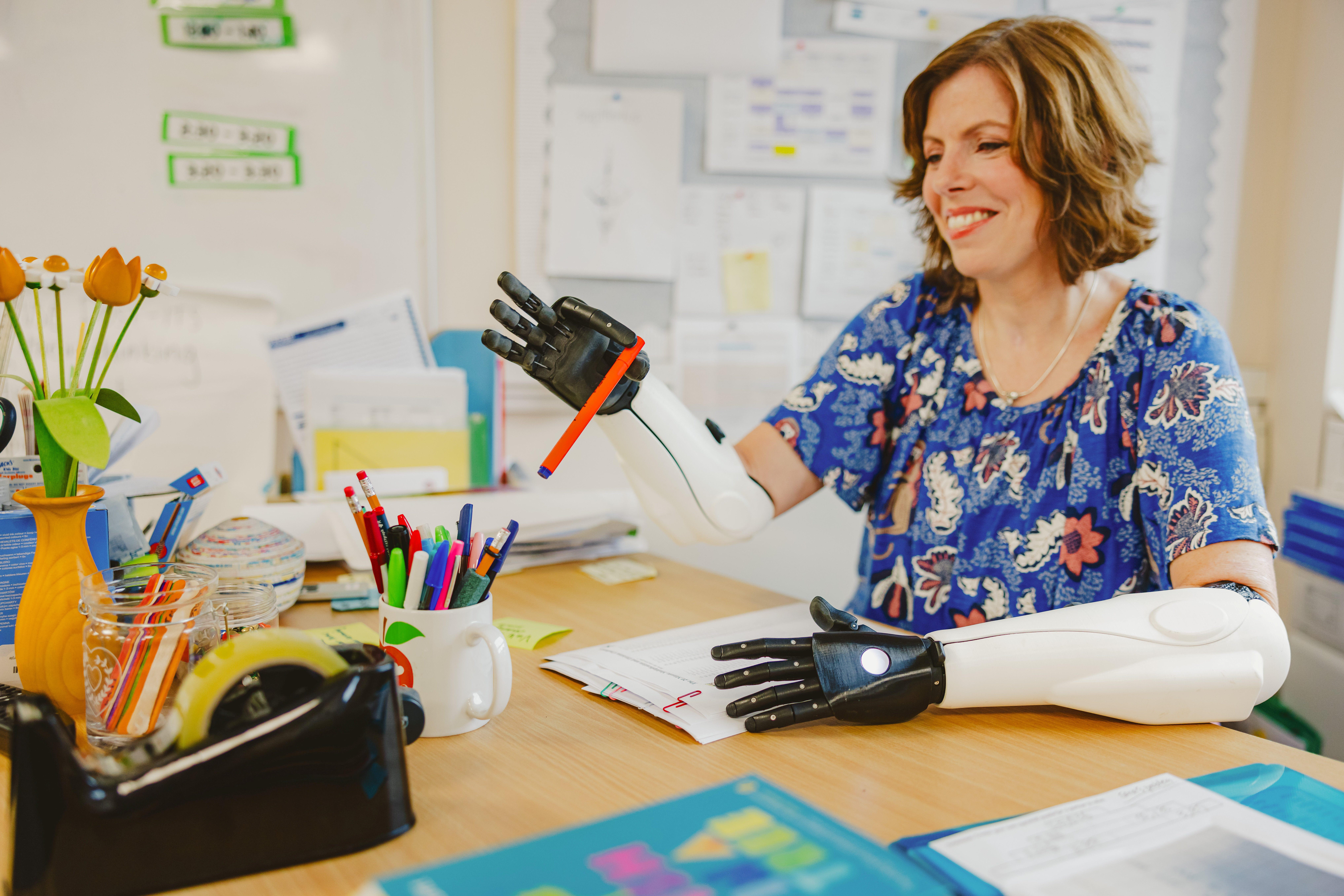 Superhuman miss: London teacher who loses limbs with sepsis returns to classroom with bionic arms and legs