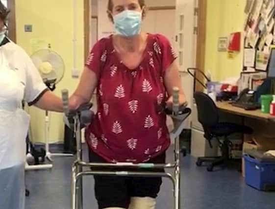 Teacher Kath Tregenna from London in hospital during her recovery from sepsis. Credit: Paul Underhill / Open Bionics SW