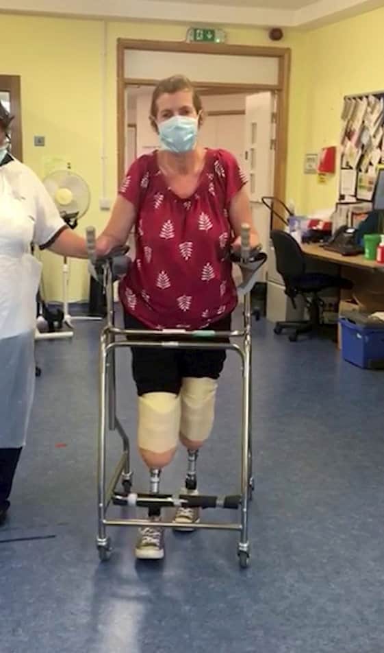 Teacher Kath Tregenna from London in hospital during her recovery from sepsis. Credit: Paul Underhill / Open Bionics SW