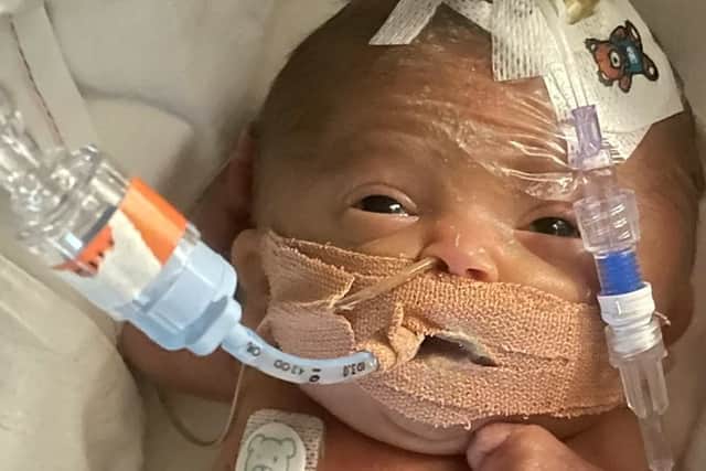 Little Chay Jefferys weighed just 1lbs when he was born at 23 weeks on 2nd June 2021. Credit: Megan Mcgee / SWNS