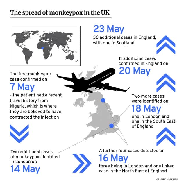 The first monkeypox infection in England was confirmed on 7 May 2022 