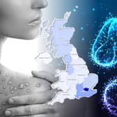 There are more than 1,000 cases of monkeypox in the UK.