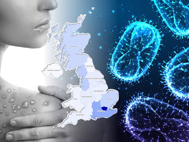 There are more than 1,000 cases of monkeypox in the UK.
