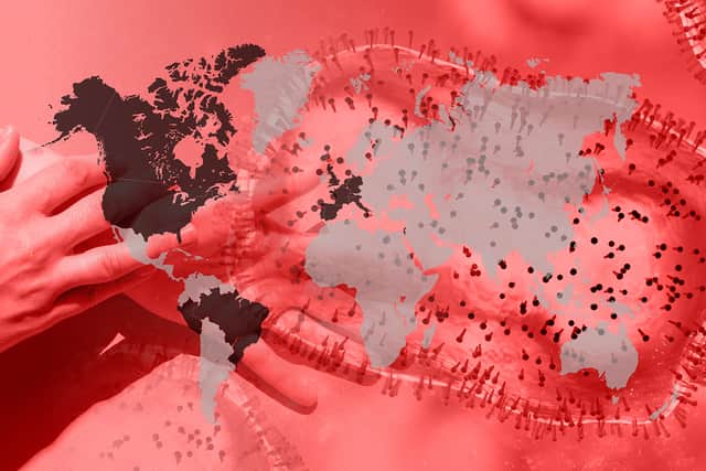 Thousands of monkeypox cases have been identified around the world.