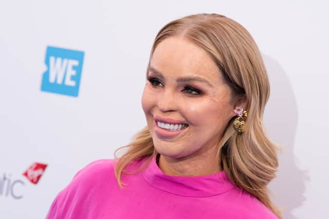 TV presenter Katie Piper has opened up about the acid attack that changed her life in 2008, including what her life was like before and after the attack.