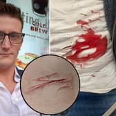 A man went to hospital after a random stabbing in a public park - which was so quick he didn’t even realise it had happened. Photo: SWNS