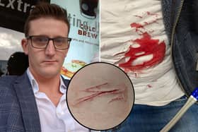 A man went to hospital after a random stabbing in a public park - which was so quick he didn’t even realise it had happened. Photo: SWNS