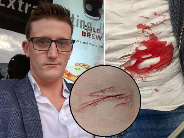A man went to hospital after a random stabbing in a public park - which was so quick he didn’t even realise it had happened. Photo: SWNS