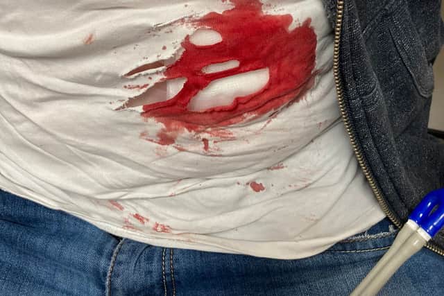 Thomas Ormrod’s bloodied t-shirt worn during the stabbing. Photo: SWNS