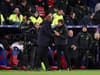 Crystal Palace boss Patrick Vieira explains why he’s not upset despite 4-0 Tottenham thrashing 