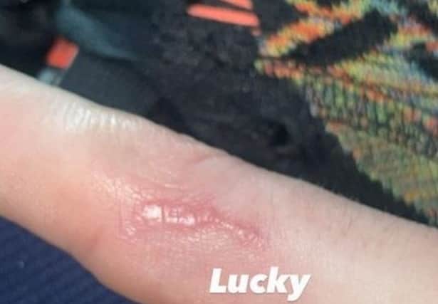 Joey Essex has shared his grusome Dancing on Ice injury showing a nasty scar on his finger (@joeyessex - Instagram)