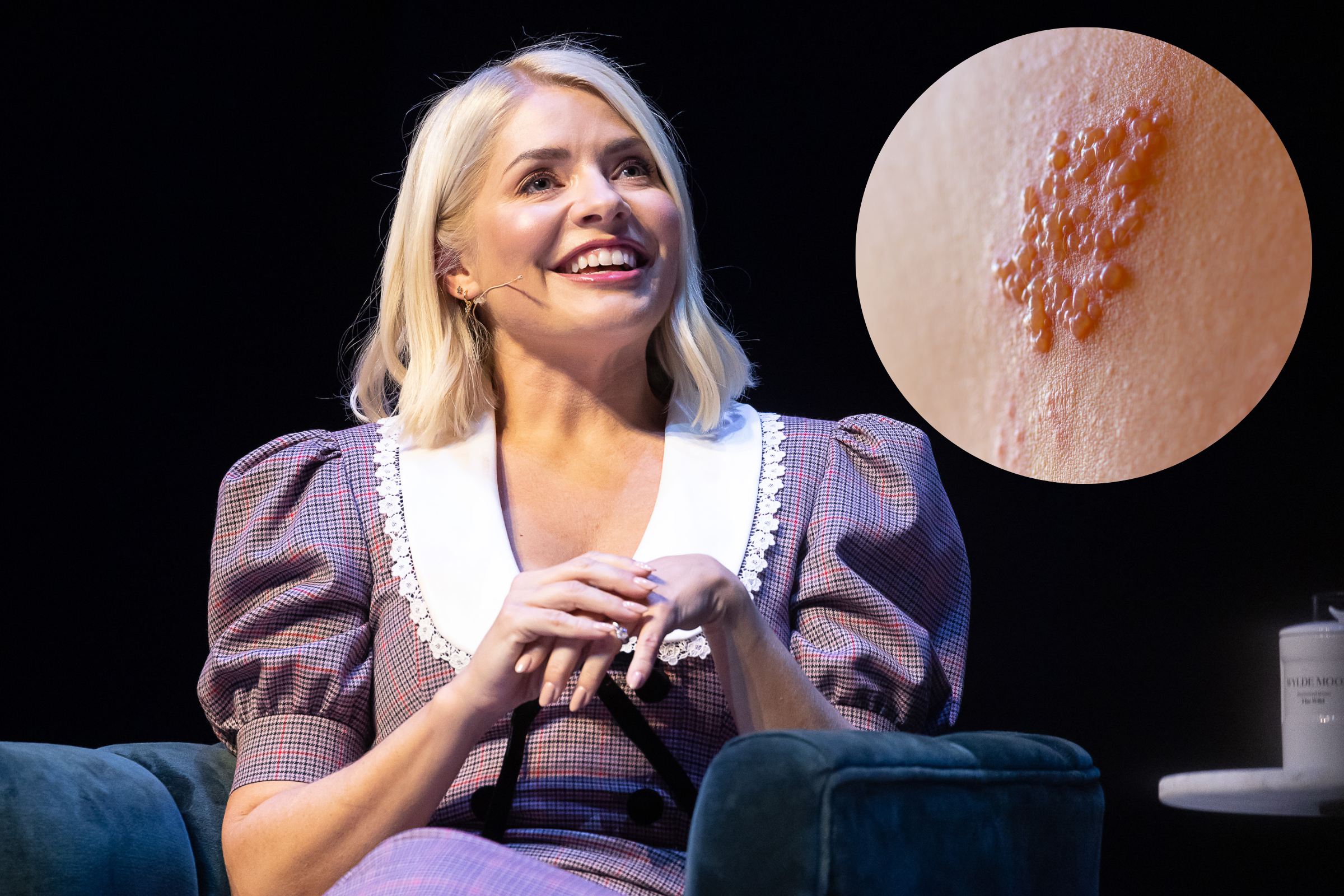 What is shingles and is it contagious? Symptoms and treatment as Holly Willoughby misses This Morning