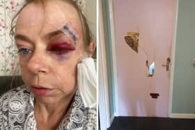 Lorna Martin suffered an injury to her head after tripping on a hole in her shower. Other issues with her Lewisham home included cracks in the walls and damaged doors. Credit: Inked PR.
