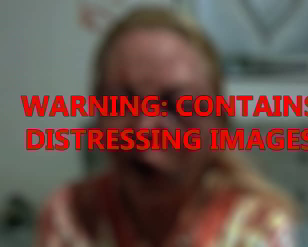 A mum was left ‘unrecognisable’ after attack 