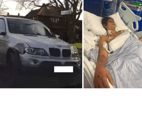 Rajdeep Kaur in hospital and the BMW which struck her. (Photos by MPS)