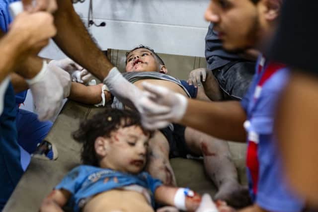 Warning: Graphic content: Injured children at Al-Shifa hospital