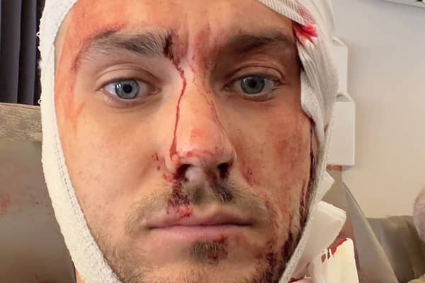 Bradley Richards, 29, was left with six fractures in his spine and neck and internal bleeding