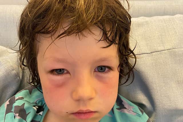 Lawrence, 8, after he was gassed by police after being caught in a pro-Palestine protest in Paris.