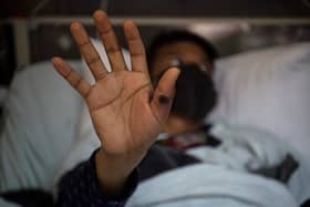 The WHO has declared a global health emergency over an outbreak of mpox in Africa. (Photo: ERNESTO BENAVIDES/AFP via Getty Images)