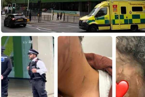 A GoFundMe has been set up for the 14-year-old victim of an acid attack