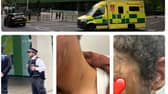 A GoFundMe has been set up for the 14-year-old victim of an acid attack