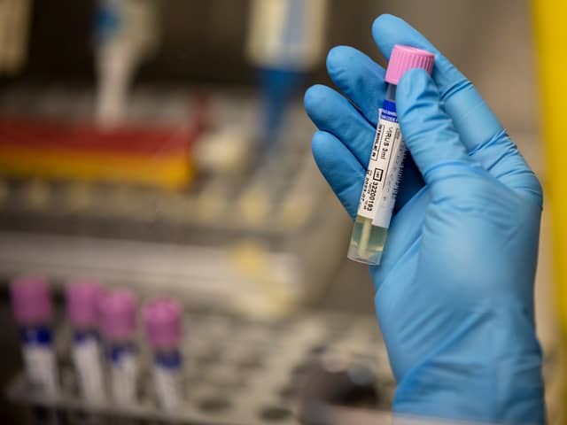 A monkeypox testing lab was set up in Madrid in Spain in 2022. 