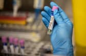 A monkeypox testing lab was set up in Madrid in Spain in 2022. 