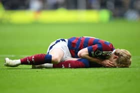Anthony Gordon took a blow to the face against Spurs.