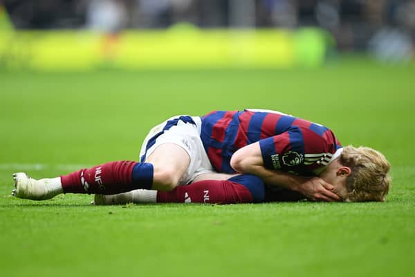 Anthony Gordon took a blow to the face against Spurs.