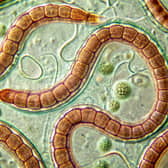 The tapeworm diet dates back to the Victorian era and can have dangerous consequences for your health.