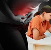 If you woke up with your first symptoms of endometriosis today, you’re likely not to get a diagnosis until 2034