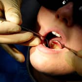 File photo dated 19/05/11 of a dentist at work. Millions of children in England were not seen by an NHS dentist last year, new figures show. Data obtained by the Liberal Democrats show that 4.4 million children in England were not seen by an NHS dentist in the year to June 2023. Issue date: Tuesday September 19, 2023.