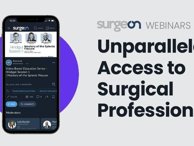 SurgeOn