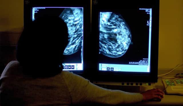 File photo dated 15/06/06 of a consultant studying a mammogram of a woman's breast, as more women will be able to get checked for breast cancer after the Government announced £10 million for new NHS screening units, the Department of Health and Social Care said.